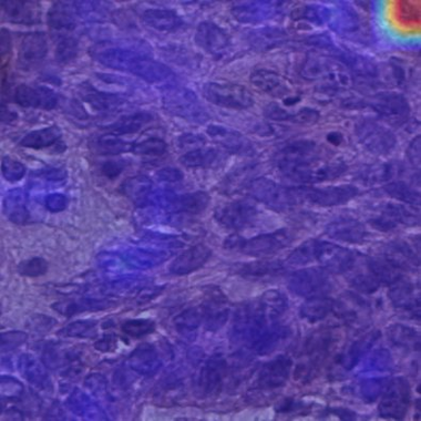 Before correction: Grad-CAM heat pooled in the top-right padding corner