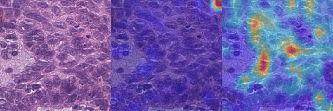 Three panels: original H&E tile, before model with heat pooled in a corner, after model with heat spread across tissue